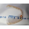X4 Zahnverblendung Pro-Line Expert©️