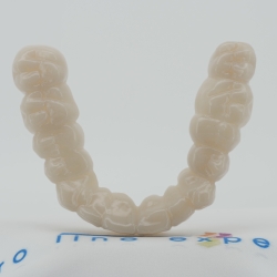 X5 Zahnverblendung - Oberkiefer - Zahnfarbe Natur