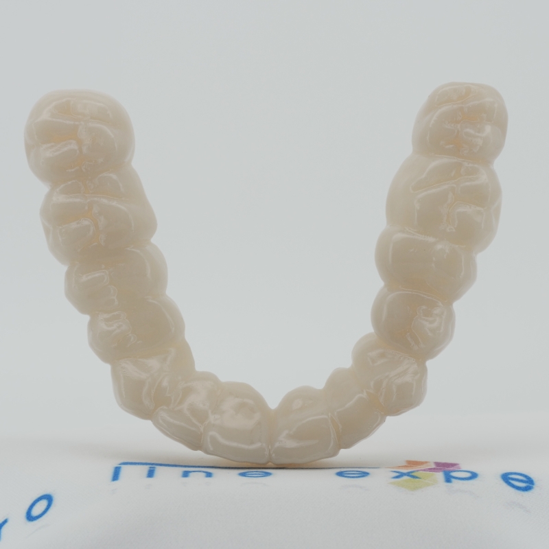 X5 Zahnverblendung - Oberkiefer - Zahnfarbe Natur