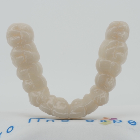 X5 Zahnverblendung - Oberkiefer - Zahnfarbe Natur