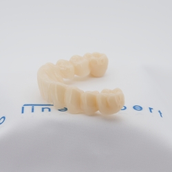 X5 Zahnverblendung Pro-Line Expert